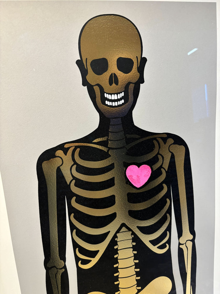 Framed Skeleton Gold