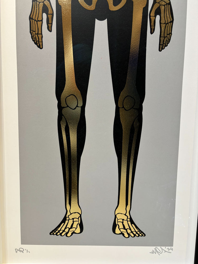 Framed Skeleton Gold